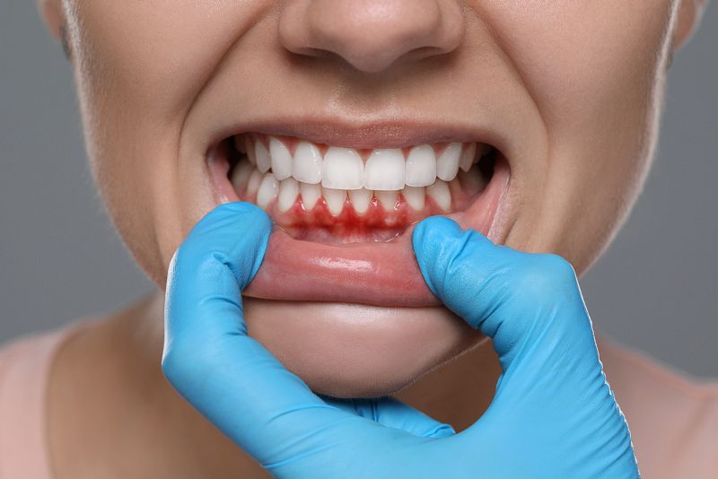 Why the people get teeth and gum hurts