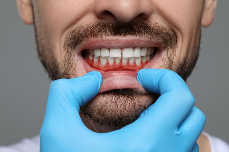 Why the people get teeth and gum hurts