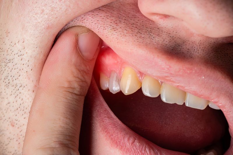 7 Surprising Causes of Throbbing Gums You Need to Know