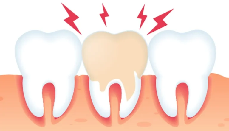 Unbearable Tooth Pain What To Do