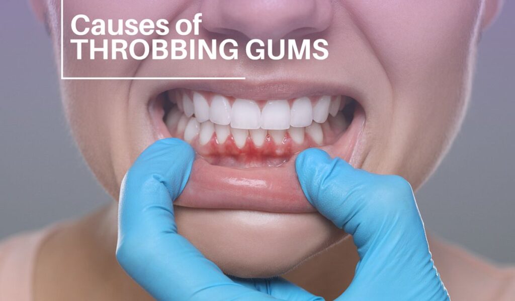 7 Surprising Causes of Throbbing Gums you need to know