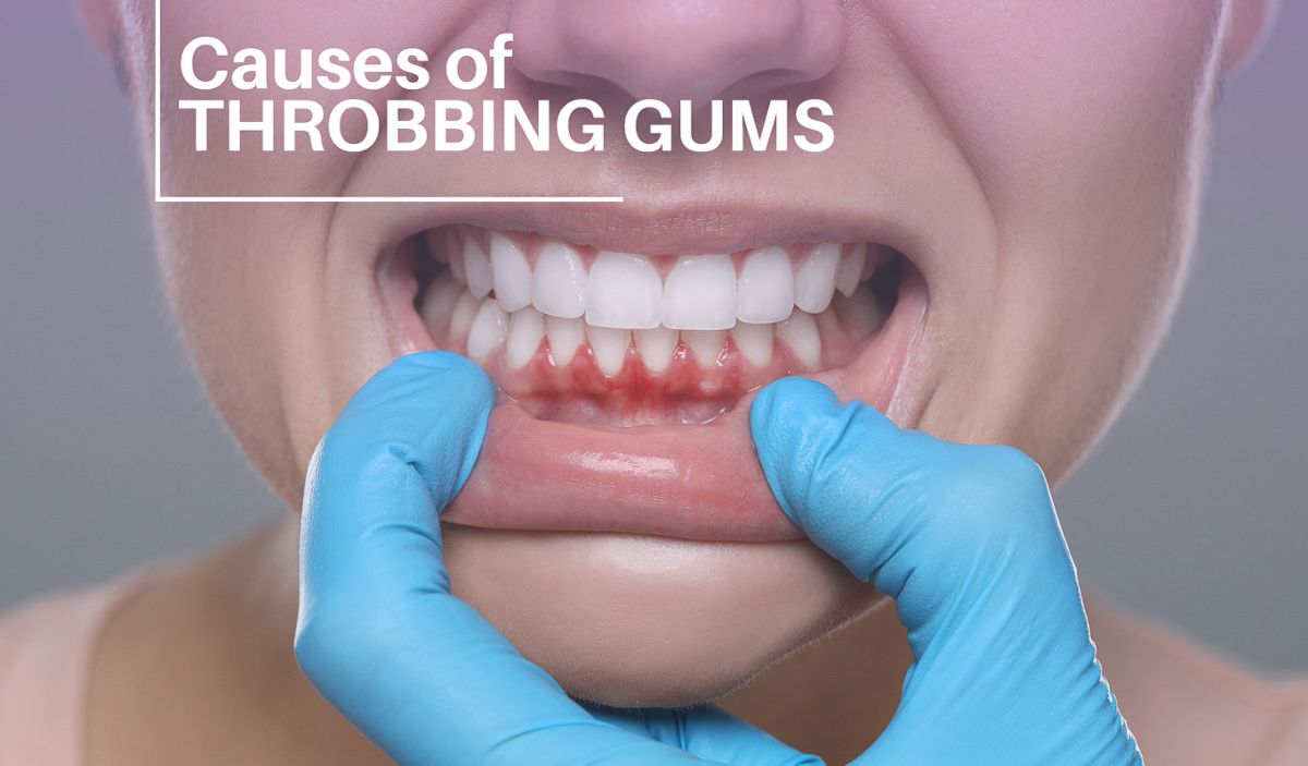 7 Surprising Causes of Throbbing Gums you need to know